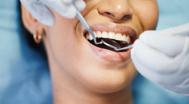 Best Emergency Treatment for Dental Infections or Abscesses in Racine, WI