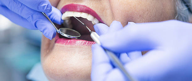 Best Urgent Care for Lost Fillings or Crowns in Racine, WI